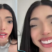 Yeri Mua se burla de la gente con ojos separados; mujer con enfermedad le responde