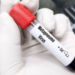 Metapneumovirus en China; ¿Qué tan preocupante es?