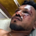 Sobrevive un pasajero al avionazo de la India.